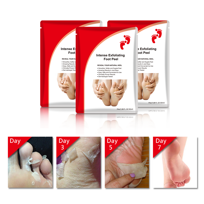 Maschera peeling per i piedi rimuovi-callosità con acido glicolico - 4